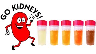 How Kidney Failure Works | Nerd Nite Melbourne