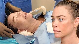 Inside Denise Richards Facelift: Never-Before-Seen Footage From Shocking Transformation (Exclusive)