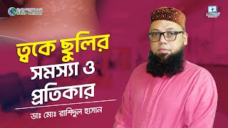 ত্বকের দাগ দূর করার উপায় | How To Remove Spots From Face | ত্বকের ছুলি দূর করার উপায়