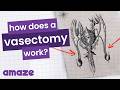 Vasectomy: What is it? #AskAMAZE