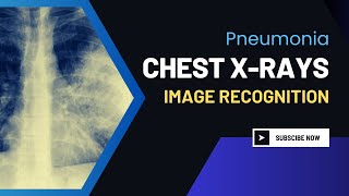 Chest X-rays Image Recognition: Pneumonia