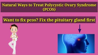 Polycystic Ovary Syndrome | pcos | hindi | #pcos #pcod #ayurveda
