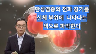 신체 부위에 나타나는 색을 살펴보면 만성 염증을 퍼뜨리는 장기를 알수 있다!