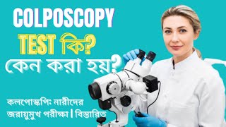 Colposcopy test What is a colposcopy test, why is it done? Why is a colposcopy test done - Bangladesh