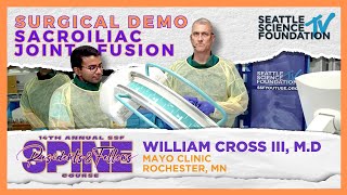 Surgical Demo : Sacroiliac Joint Fusion - William Cross, M.D.