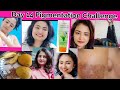 Pigmentation Challenge 14 Day whole day routine how to eat healthy food for spotless glowing skin