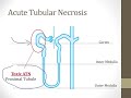 05 Tubulointerstitial Disease