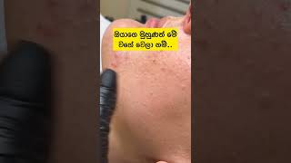 වැඩි විස්තර කමන්‍ට් එකේ තියෙනවා 😇 #fyp #foryou #viral #trending #beauty #skincare