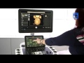 How to Perform a 4D Acquisition on a Philips EPIQ Ultrasound System How to Perform a 4D Acquisition on a Philips EPIQ Ultrasound System