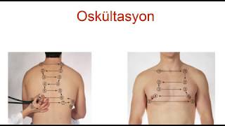 Solunum sistemi muayenesinde oskültasyon:  Normal ve patolojik solunum sesleri dersi