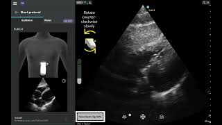 Vscan Air⢠Product Tutorial | Caption AIā¢