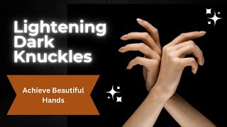 How to Lighten Dark Knuckles: Effective Home Remedies● Say Goodbye to Dark Knuckles