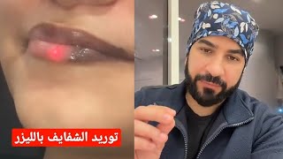 توريد الشفايف بالليزر تجربتي ونصيحتي لكم lip laser treatment