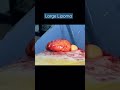 large lipoma removal a non emergency procedure