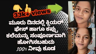 ಮೂರು ದಿನದಲ್ಲಿ ಕ್ಲಿಯರ್ ಫೇಸ್ ಹಾಗೂ ಕಪ್ಪು ಕಲೆಯನ್ನು ಸಂಪೂರ್ಣವಾಗಿ ಹೋಗಿಸಬಹುದು 100% ನೀವು ಕೂಡ ಟ್ರೈ ಮಾಡಿ |