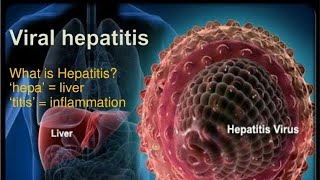 HEPATITIS-PATHOLOGY