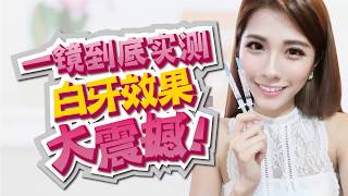 爆款美妆神器，牙齿美白实测，美白牙齿效果大震撼！Teeth Whitening【FW+PLUS菲斯华】