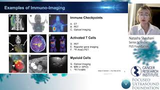 Cancer Immunotherapy Workshop 2021 – Introduction to Imaging Applications in Immuno-Oncology
