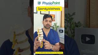 Spondylolisthesis in hindi #drsuniltank #exercises #shorts