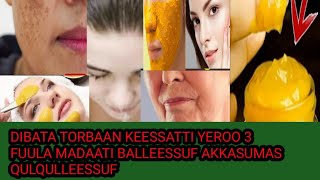 DIBATA TORBAAN KEESSATTI YEROO 3 FUULA MADAATI BALLEESSUF AKKASUMAS QULQULLEESSUF