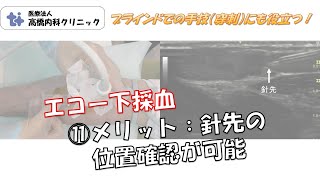 エコー下採血　⑪針先の位置確認が可能