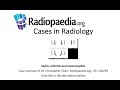 Septic arthritis and osteomyelitis (Radiopaedia.org) Cases in Radiology