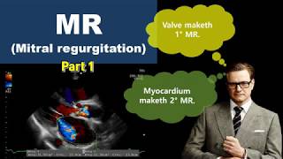 [허내과] Mitral regurgitation 승모판 폐쇄부전 1부