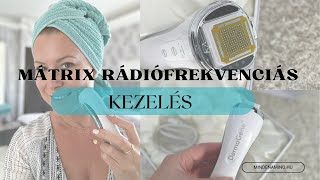 DermaGene FaceTight Mátrix Rádiófrekvenciás Arcfiatalító Készülék -  termék tesztelés