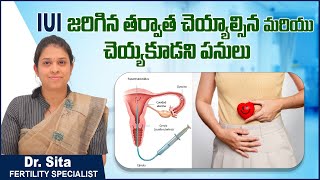 IUI తర్వాత చేయకూడనివి | Precautions After IUI | Do's and Don'ts of IUI | Boon IVF Fertility Center