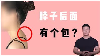 90%的女性脖子後面都有包？頸椎大包、富貴包？一招解決！