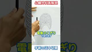 【心臓外科医】手術の正中切開　#心臓 #手術 #みんなの健康塾ちゃんねる