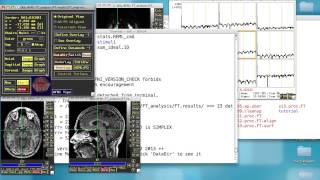 AFNI Start To Finish Tutorial, Part 6: Open AFNI Viewer