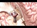 What Is The Brain Made Of?