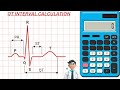 QT INTERVAL CALCULATION MADE EASY