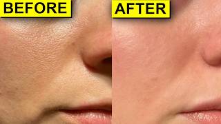 How to ACTUALLY reduce the appearance of your pores