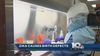 CDC: Zika definitely causes severe birth defects