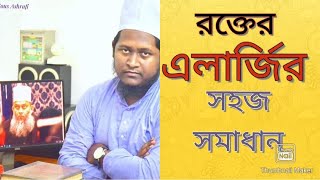 এলার্জি থেকে মুক্তির উপায়