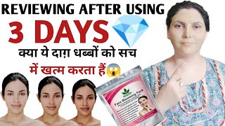 7 Days Challenge:Havintha Face Blooming Pack With the Goodness of Multani Mitti, Kalonji,Masoor Dal