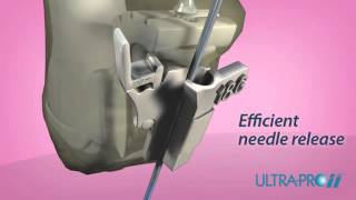 Ultra-Pro™ Needle Guidance System