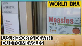 US Confirms First Measles Death Since 2015 In Texas | World DNA | World News | WION