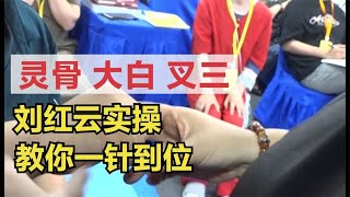 灵骨、大白、叉三，必须做到一针到位，刘红云实操教你如何下针！