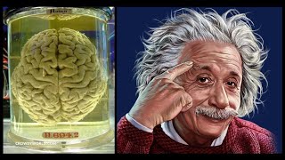 Where is Albert Einsteins brain now? #Einstein #AlbertEinstein #Museum #Brain #Shorts