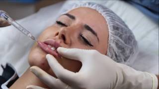 botoks and hyaluran lip augmentation _ hyaluran dudak dolgusu