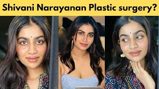 பிளாஸ்டிக் சர்ஜரி செய்த ஷிவானி நாராயணன்? போட்டோ வைரல் | Shivani narayanan lip filler plastic surgery