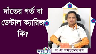 দাঁতের গর্ত বা ডেন্টাল ক্যারিজ কি ! ডাঃ মোঃ আসাফুজ্জোহা রাজ