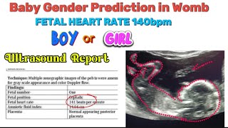 Baby Boy or girl in womb gender prediction by heartbeat ultrasound report by Fetal Heart Rate FHR