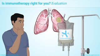 Immunotherapy Treatments for Non-Small Cell Lung Cancer (NSCLC)