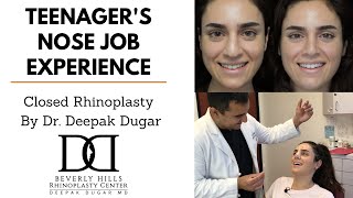 17 Year Old Scarless Nose Experience - Rhinoplasty with Dr. Deepak Dugar, Beverly Hills