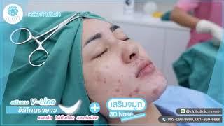 ldoli Review : จมูก3D nose  + เสริมคางUSA V-Line จมูกมา คางเป๊ะ หน้าเปลี่ยน  !!สวยมีมิติ ✨✨