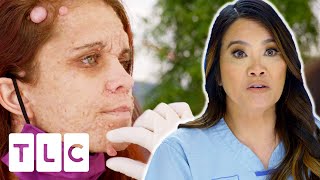 Dr Lee Helps Woman Whose ENTIRE BODY Is Covered in Cysts | Dr Pimple Popper This Is Zit | UNCENSORED